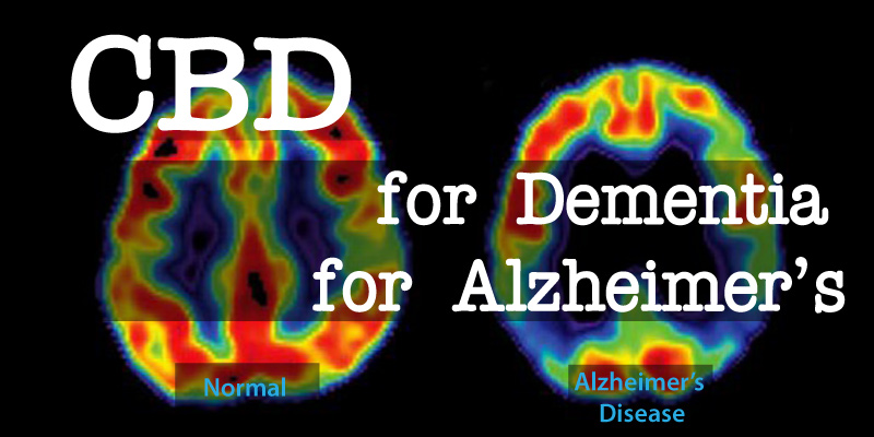 Cbd For Dementia