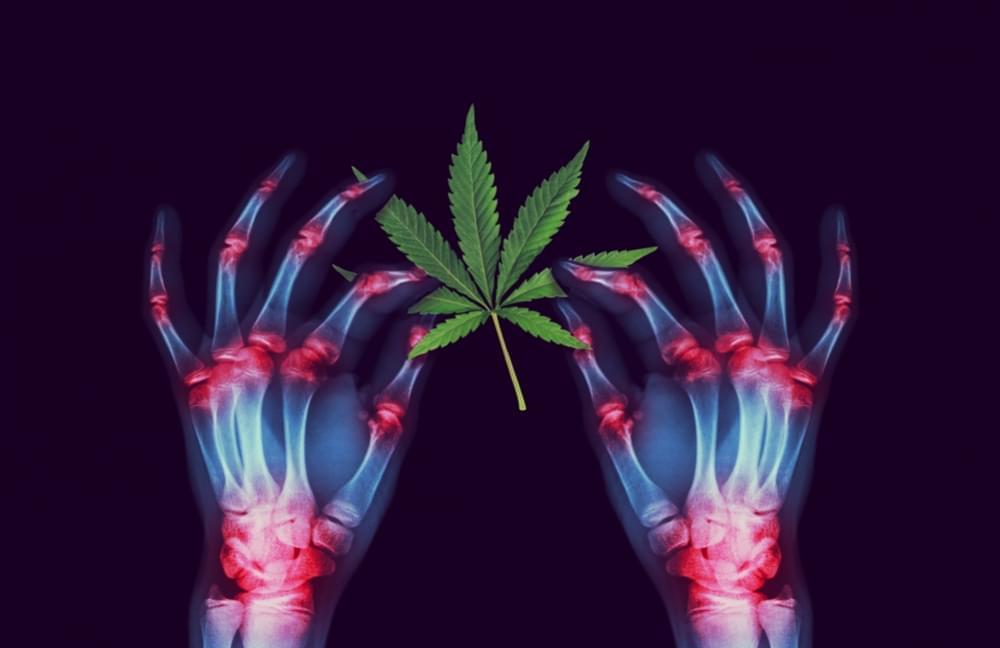 Cannabis Arthritis