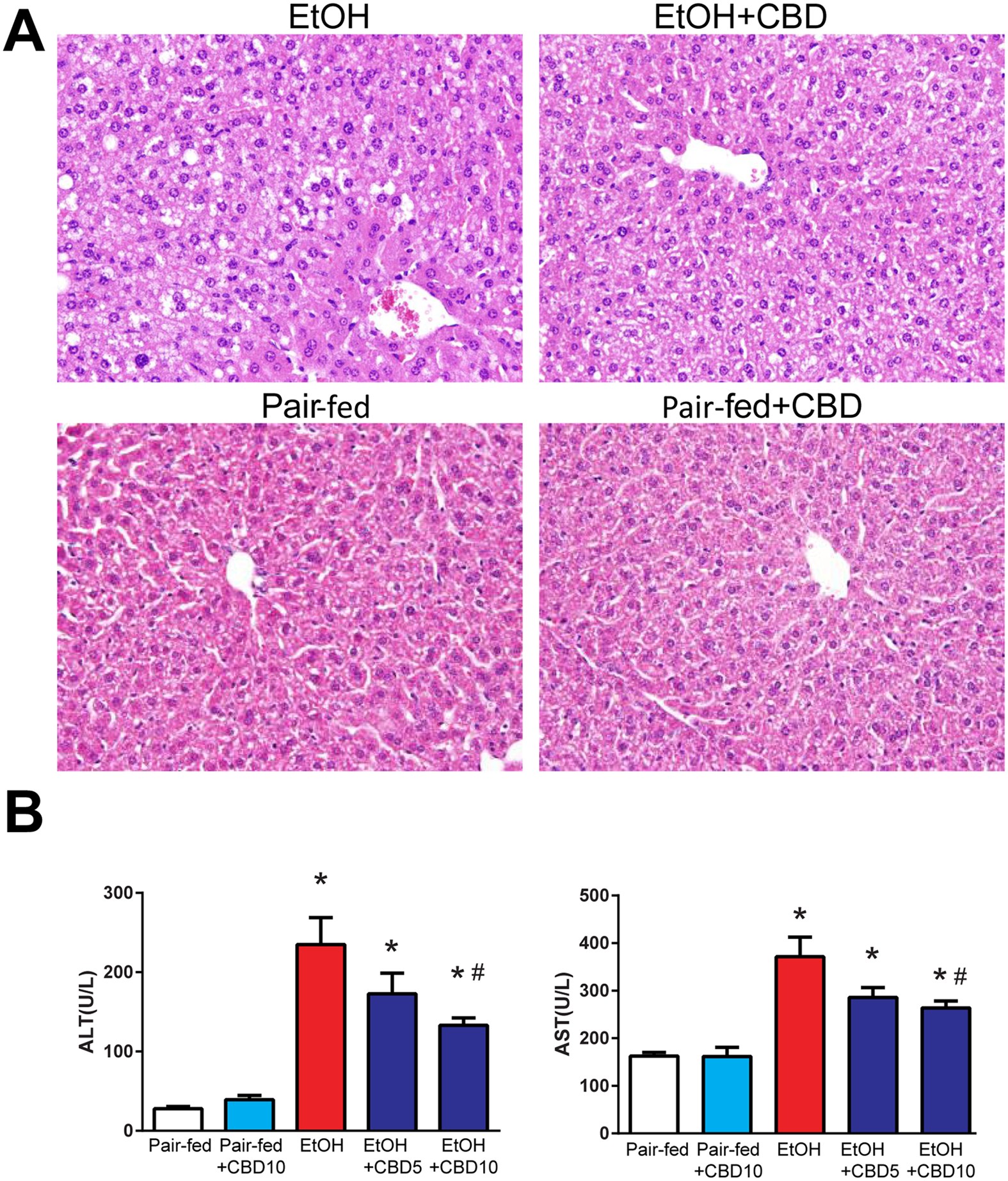 Cbd Liver Inflammation