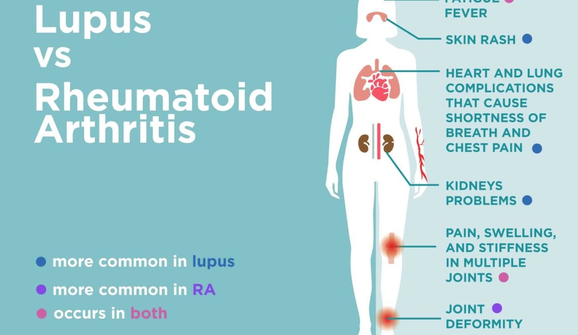 Multiple Joint Pain Without Swelling