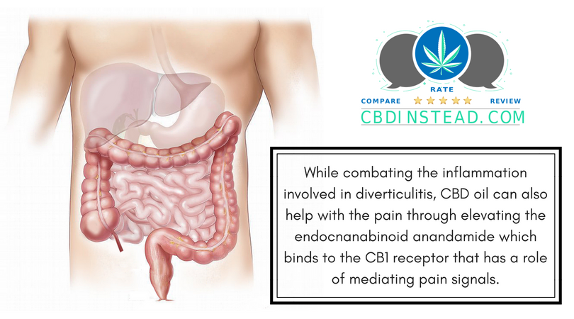 Cbd Oil For Diverticulitis