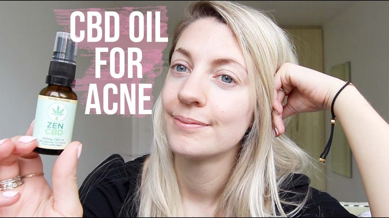 Where To Buy Cbd Oil For Acne