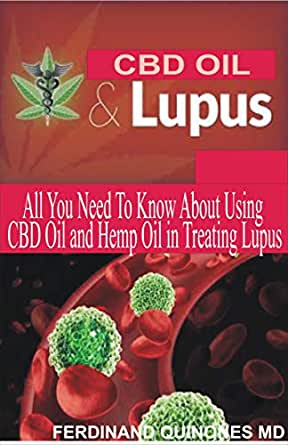Cbd Oil For Lupus