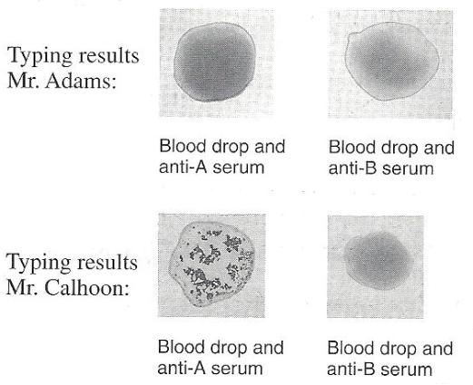 Exercise 29 Review Sheet Blood